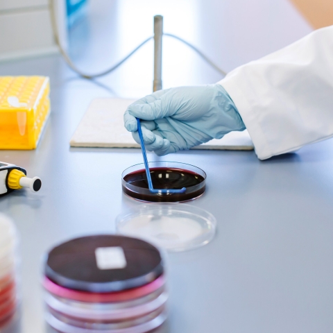 Close up of a gloved hand and some petri dishes