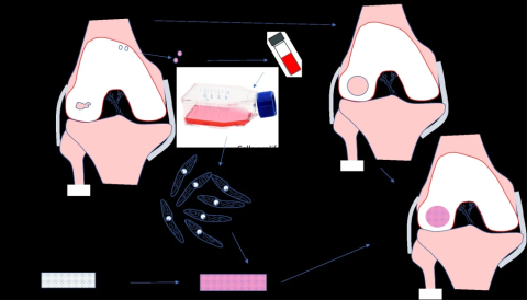 Regenerative techniques using stem cells