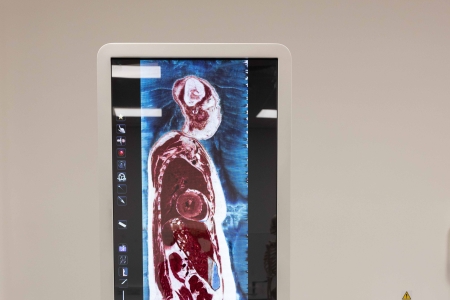 A medical imaging machine scanning the inside of the human body